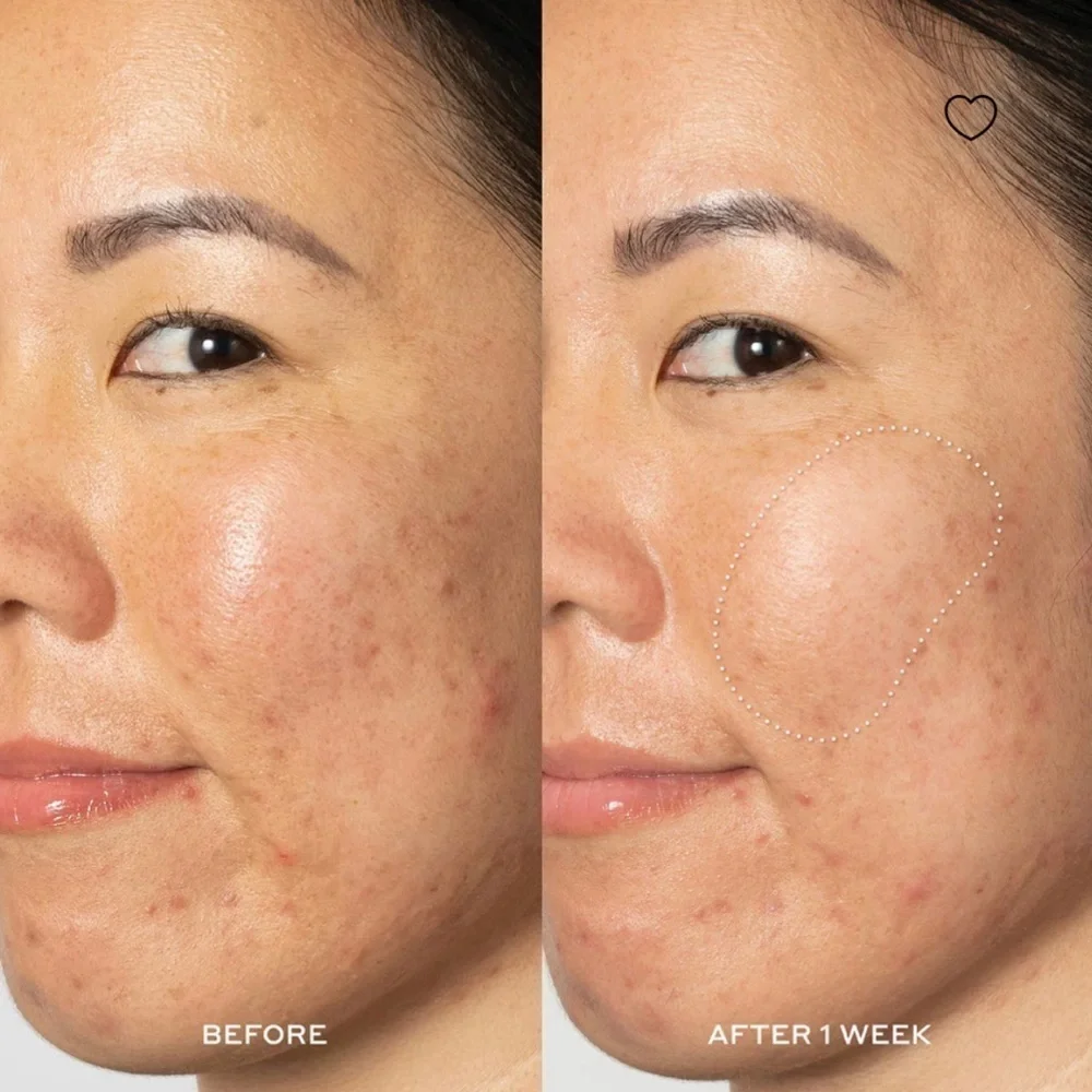 Glow2Oh Dark Spot Toner by Ole Henriksen